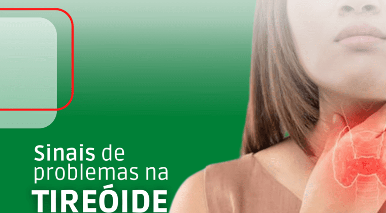 Sinais De Problemas Na Tireoide Laborat Rio Exame Agitah